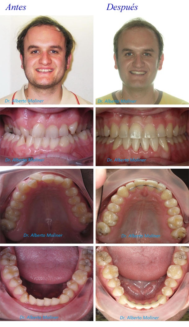 clinica ortodoncia zaragoza clinica ortodoncia zaragoza