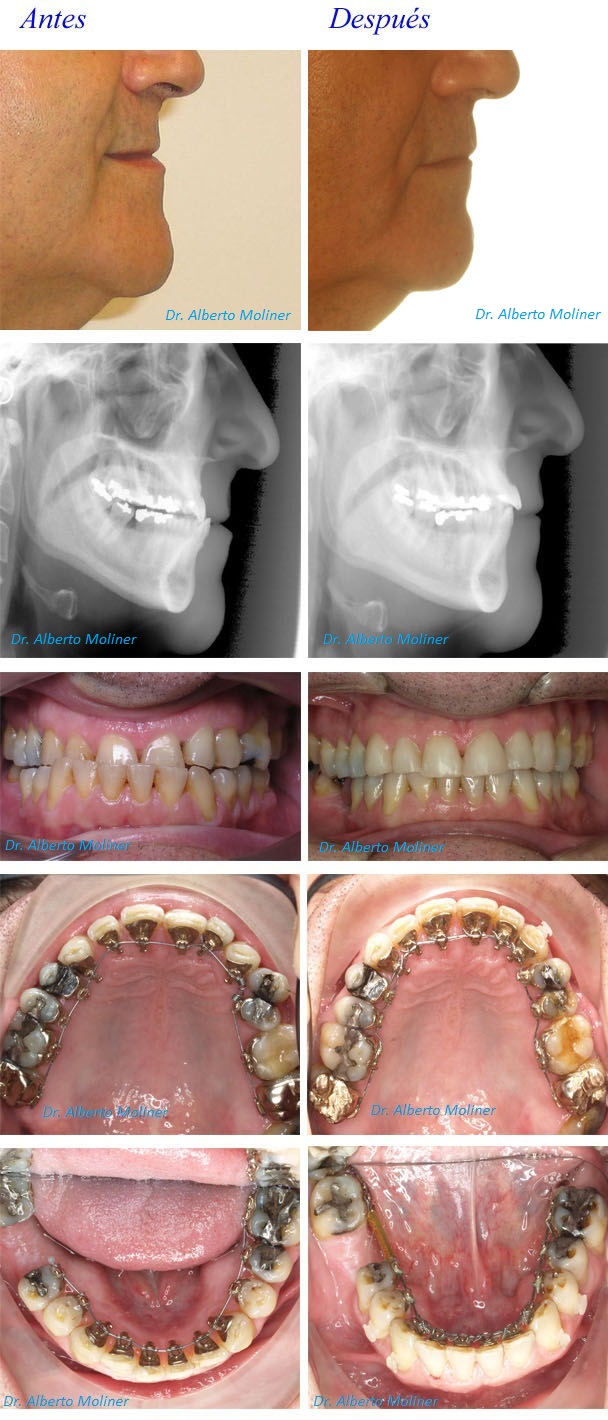 consulta ortodoncia invisible zaragoza