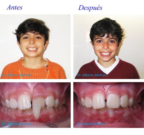 aparato dental zaragoza