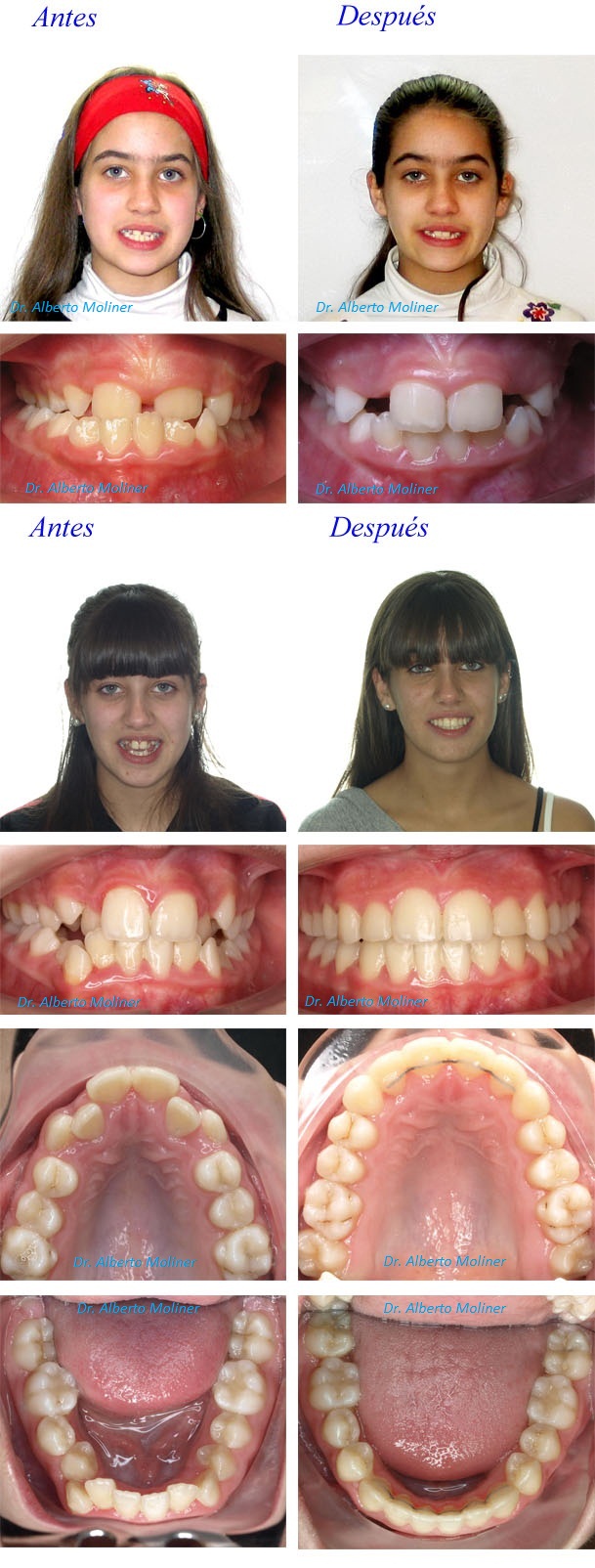 clinica ortodoncia niños zaragoza