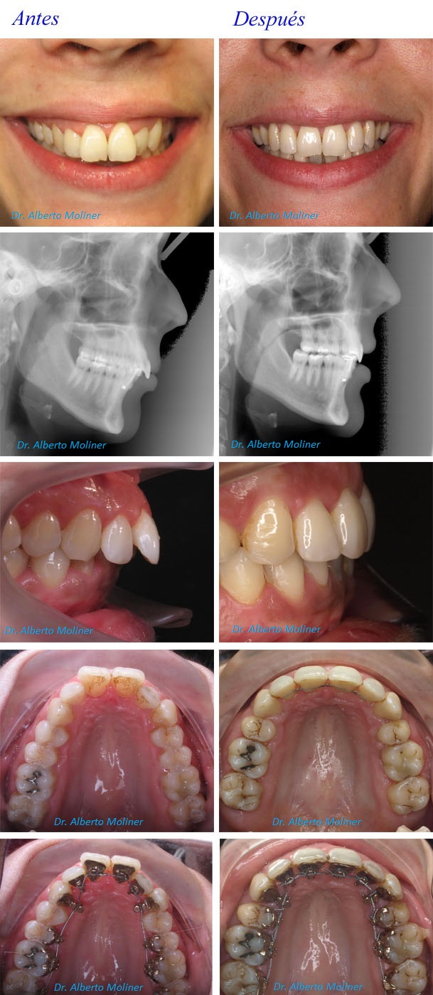 Centro ortodoncia invisible zaragoza
