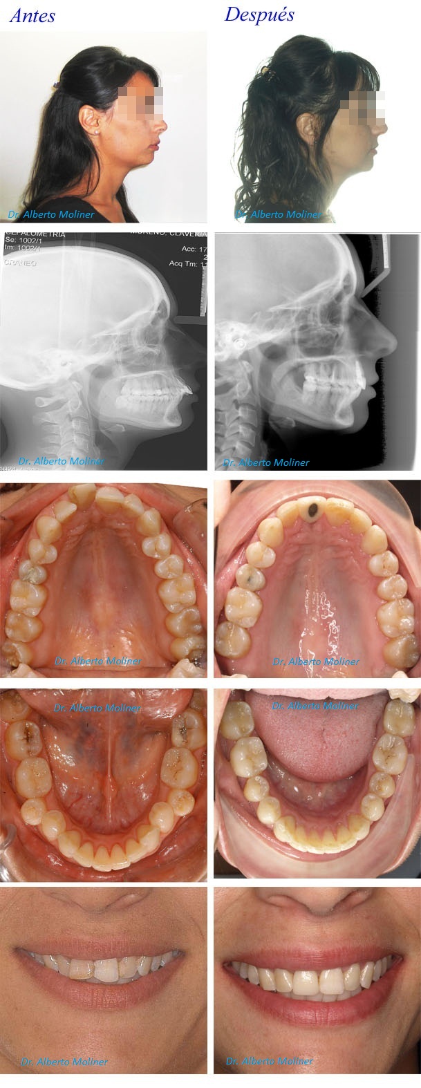 ortodoncia zaragoza