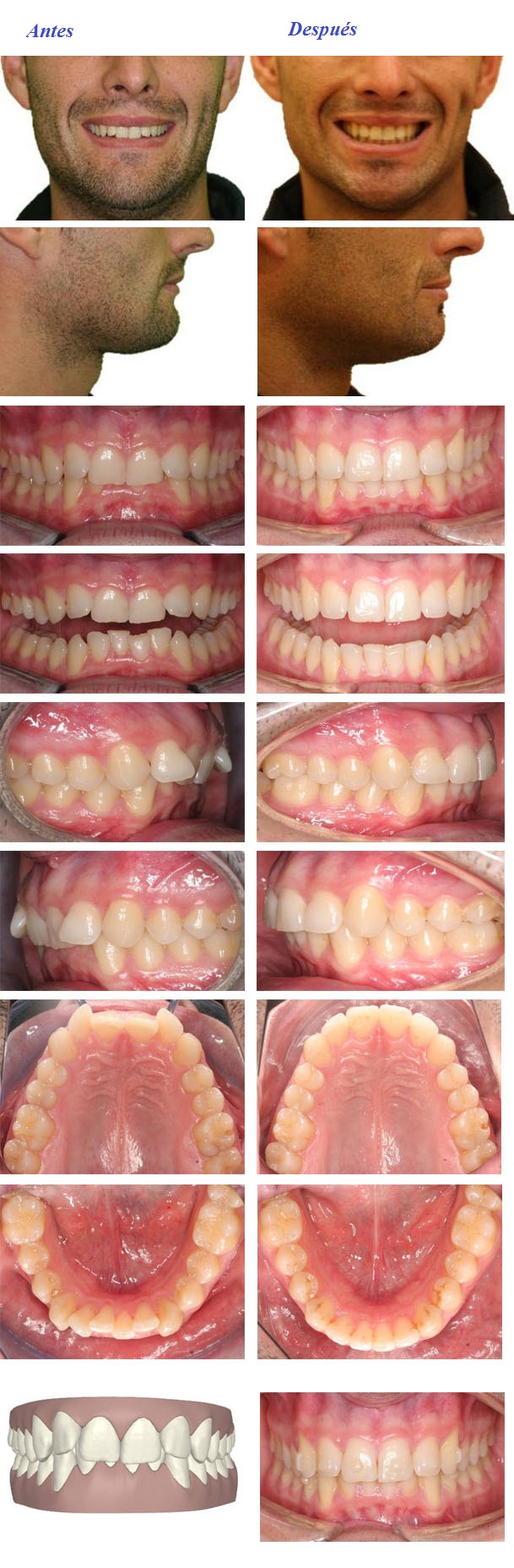 dentista invisalign zaragoza