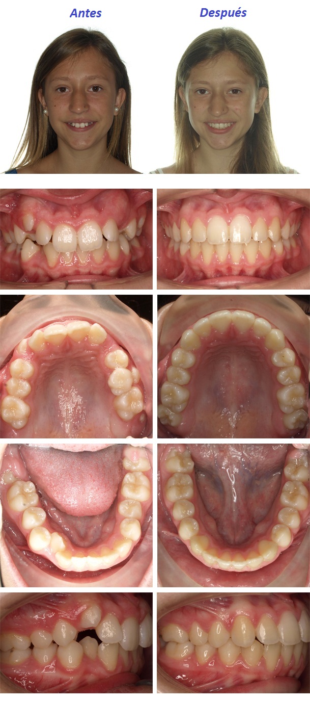 ortodoncista niños zaragoza