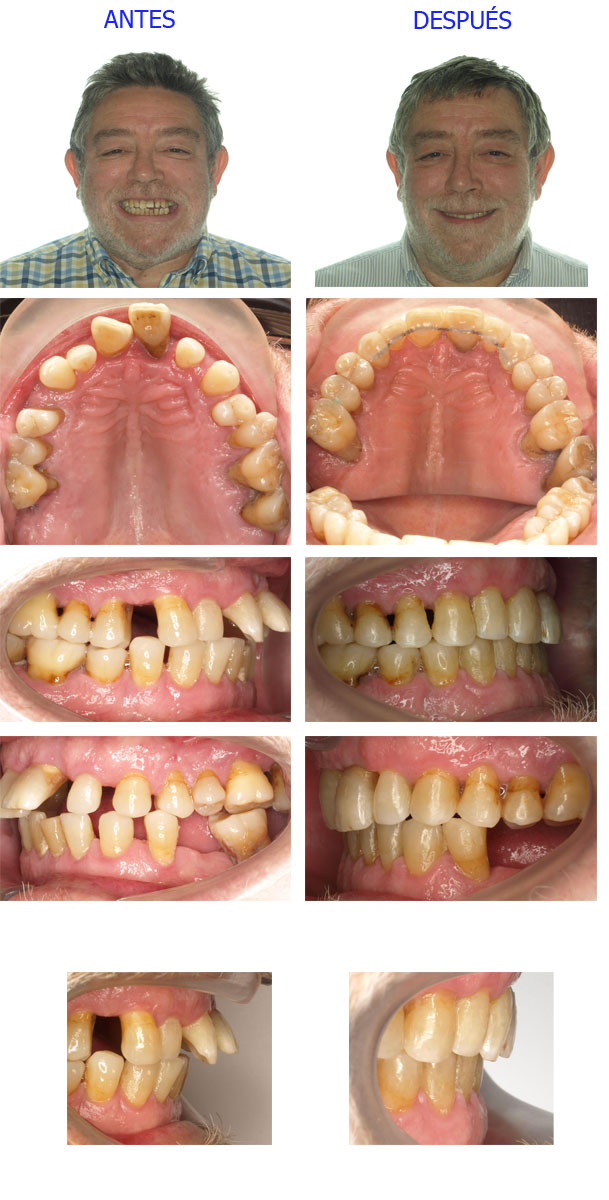 ortodoncia brackets zaragoza