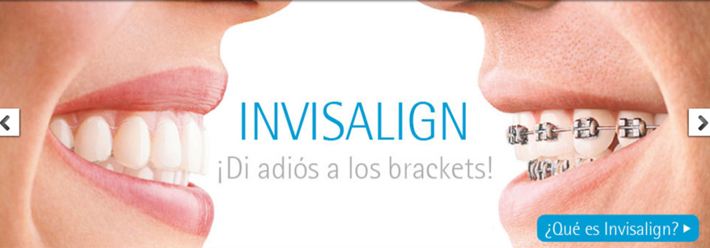 Ortodoncia Invisible, di adiós a los brackets