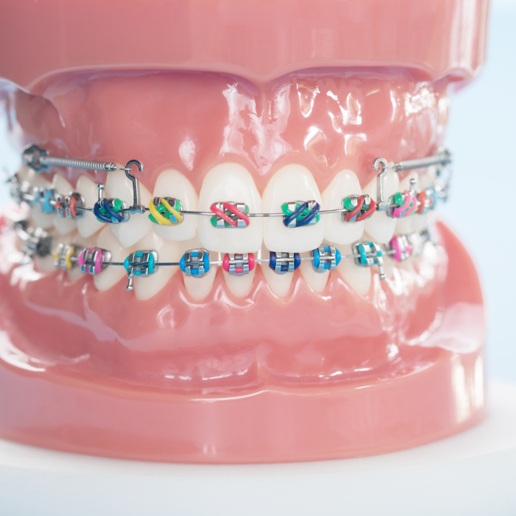 Higiene dental y cuidados con brackets