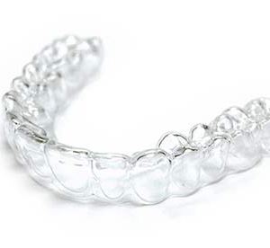 Invisalign como solución para el problema de clase II dental