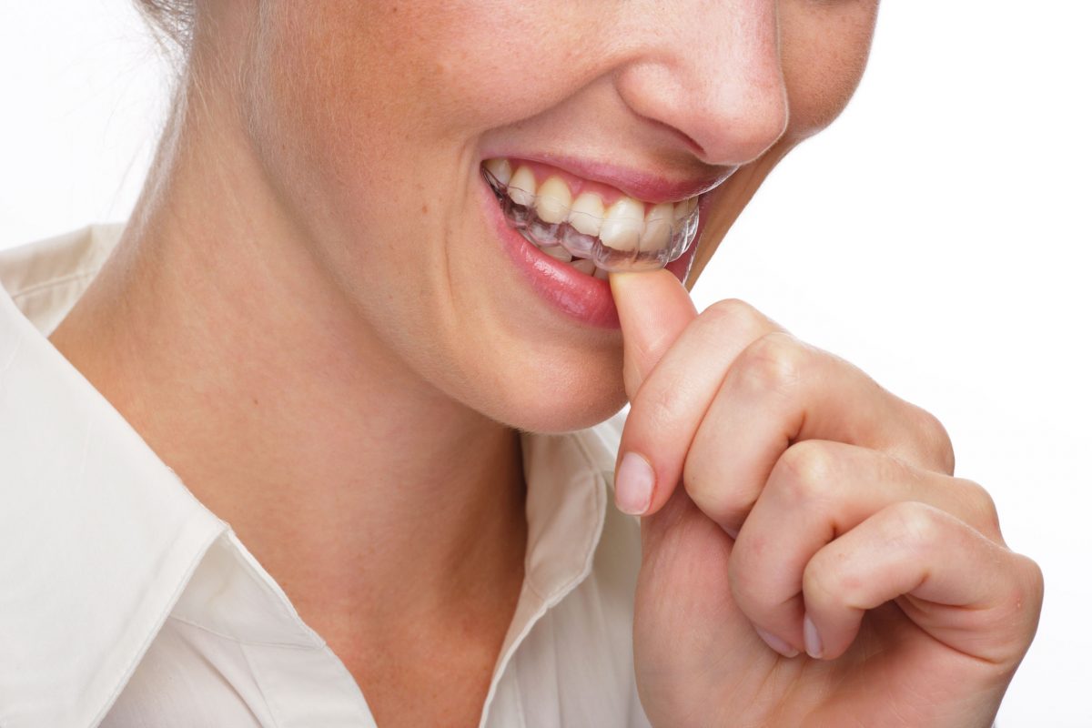 9011258 11 02 Invisalign en Ortodoncia Moliner Zaragoza