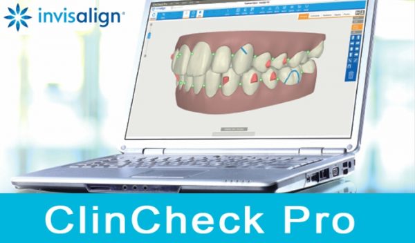 Invisalign - ClinCheck Pro