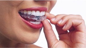 Invisalign Zaragoza