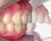 ortopediaybrackets 2 min