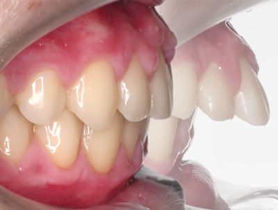 ortopediaybrackets 2 min