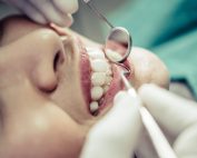 Troneras dentales: qué son, causas y cómo eliminarlas