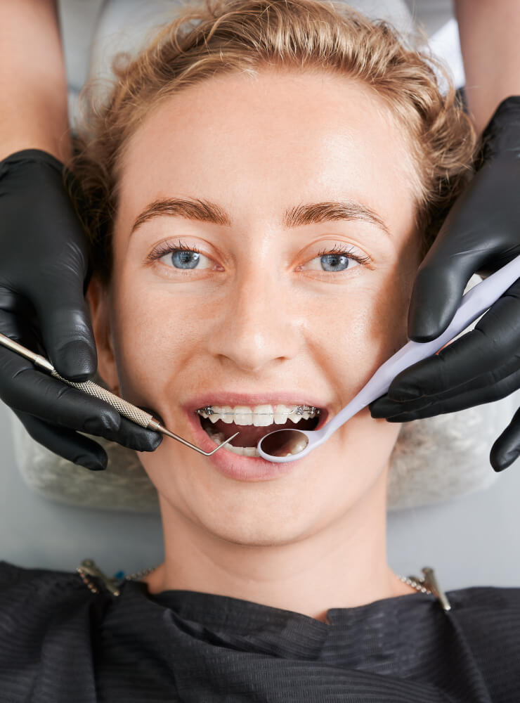 ¿Qué comer los primeros días de brackets?