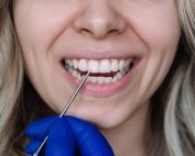 ¿Por qué salen manchas blancas en los dientes?