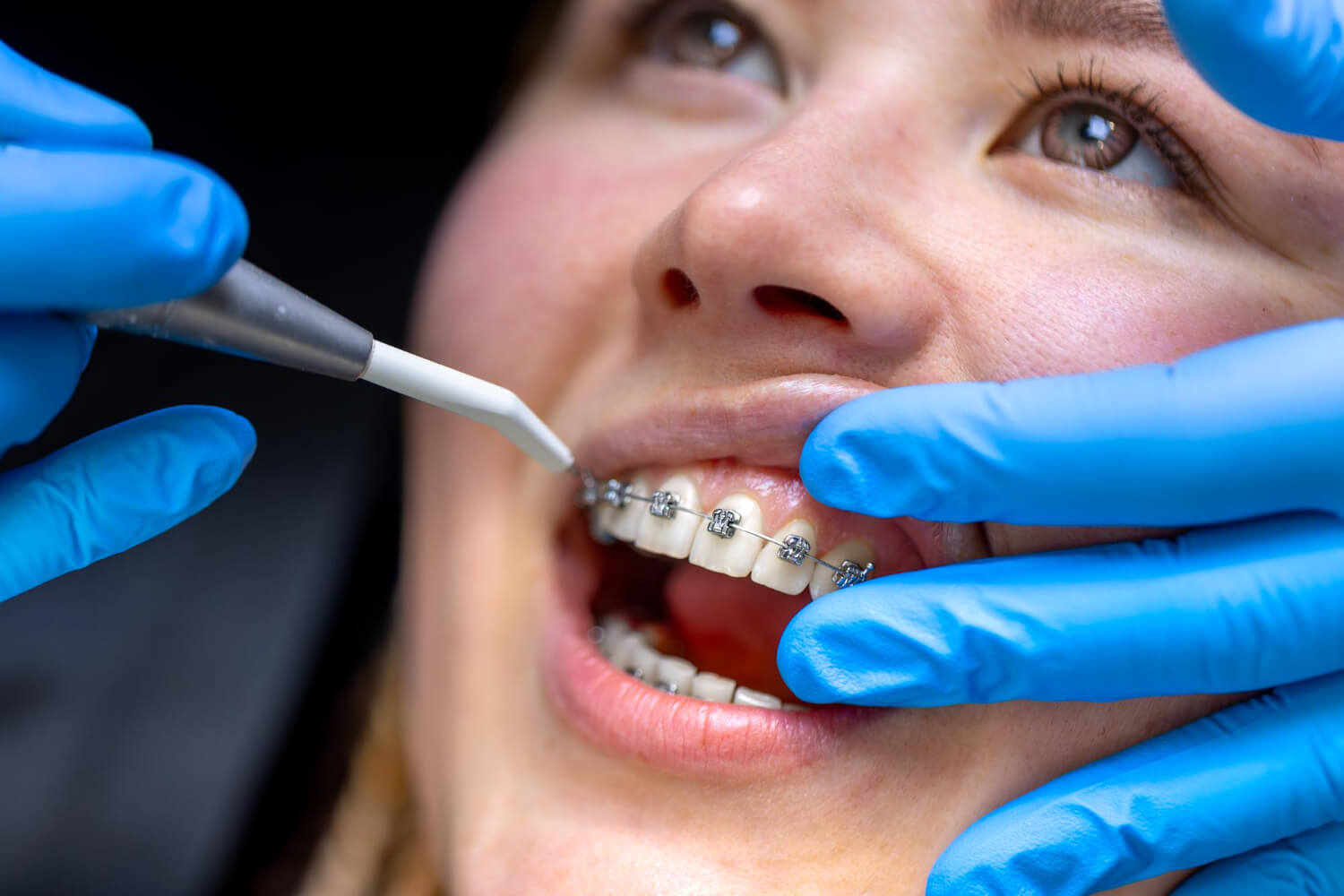 ¿Qué es la ortodoncia y la endodoncia? Diferencias, tratamientos y beneficios