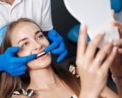 Carillas dentales o fundas