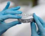 Es posible usar Invisalign solo abajo