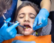 Qué es y por qué se produce una caries