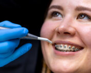 ¿Qué comer los primeros días de ortodoncia?